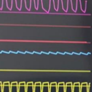 simulador-monitor-multiparametro.png